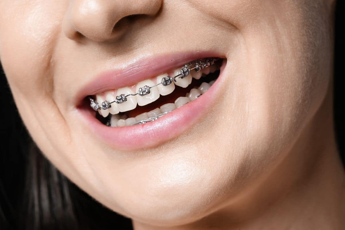 How Orthodontics Can Improve Both Function and Aesthetics